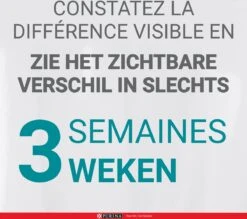 Purina One Sensitive - Kalkoen/Rijst - Kattenvoer - 800 G -Kattenbenodigdheden Winkel 1200x1063 2